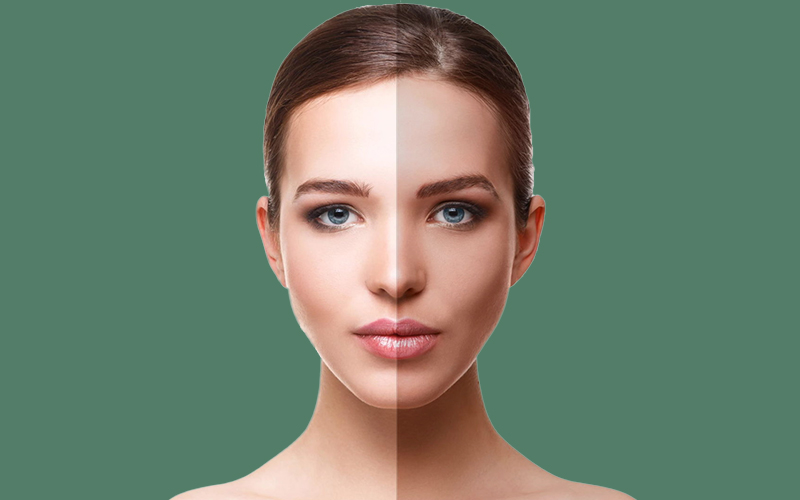 Sun-Damage-and-Sunscreen